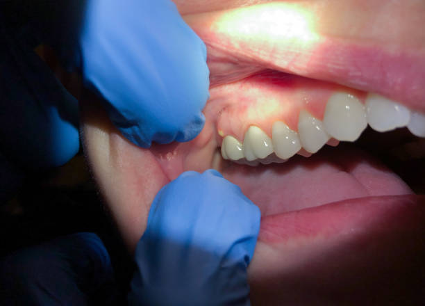 Best Emergency Orthodontic Repairs in Corcoran, MN